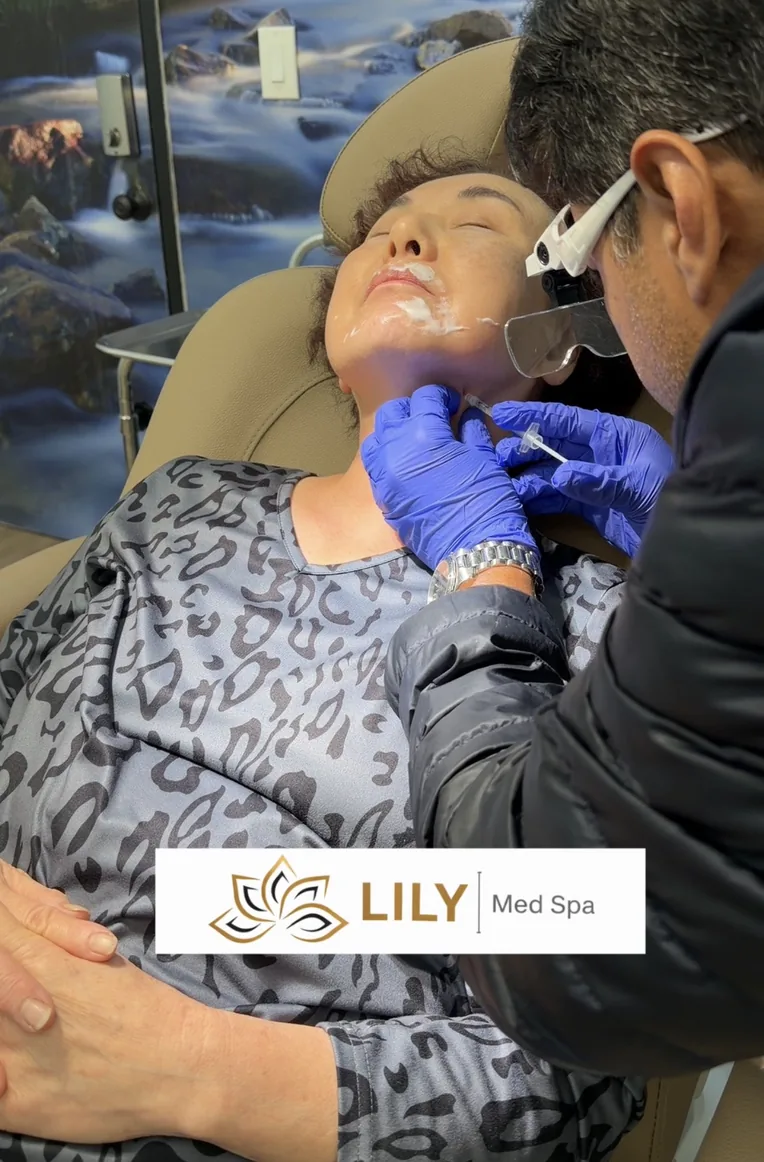 Platysma neck Botox injection at Lily Med Spa, Fullerton