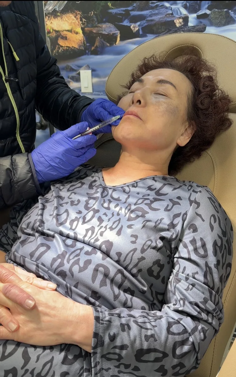 Botox injection technique at Lily Med Spa